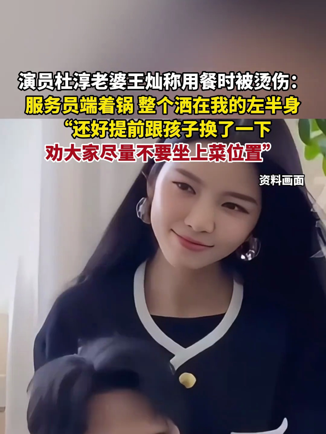 杜淳老婆王灿称用餐时被烫伤 服务员端着锅 整个洒在我的左半身