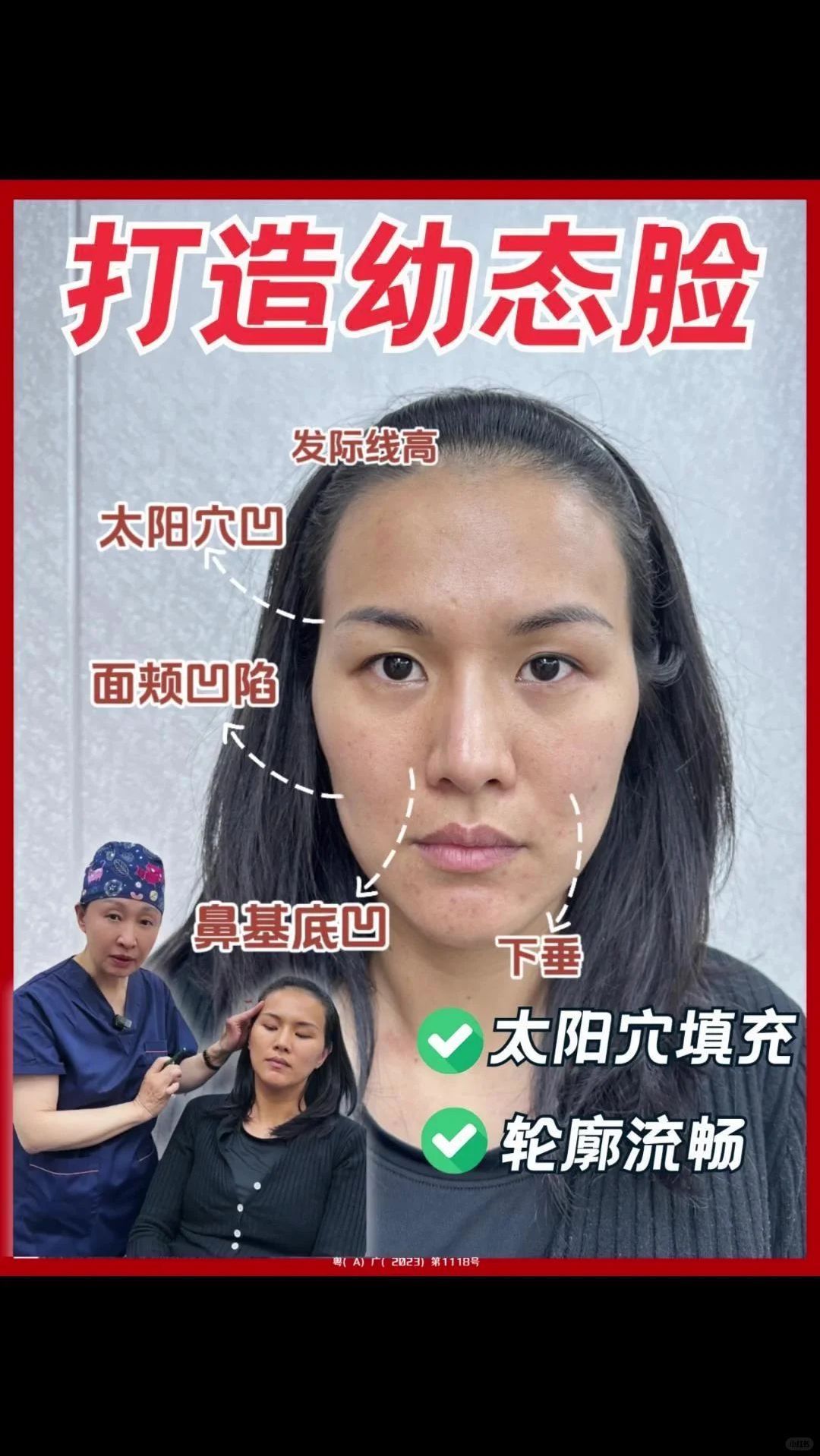 颧骨高的女生看过来 如何打造自然流畅脸