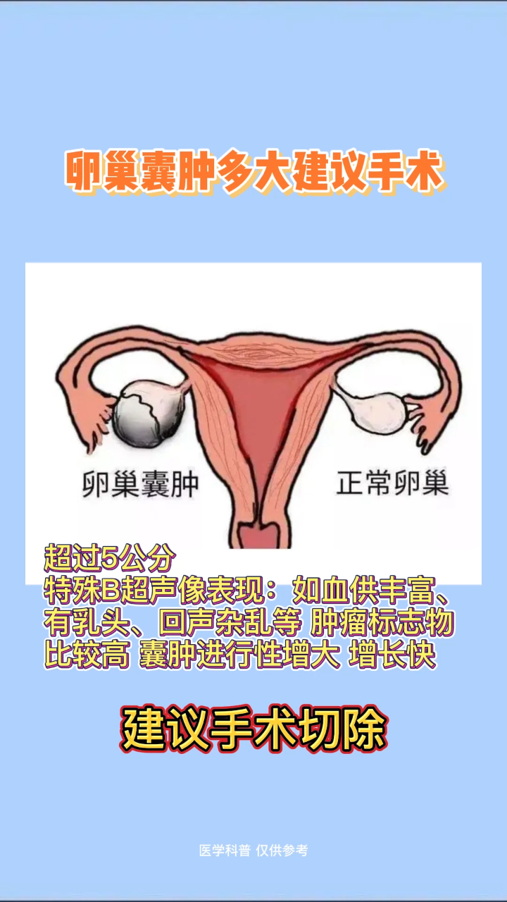 卵巢囊肿多大就是癌了图片