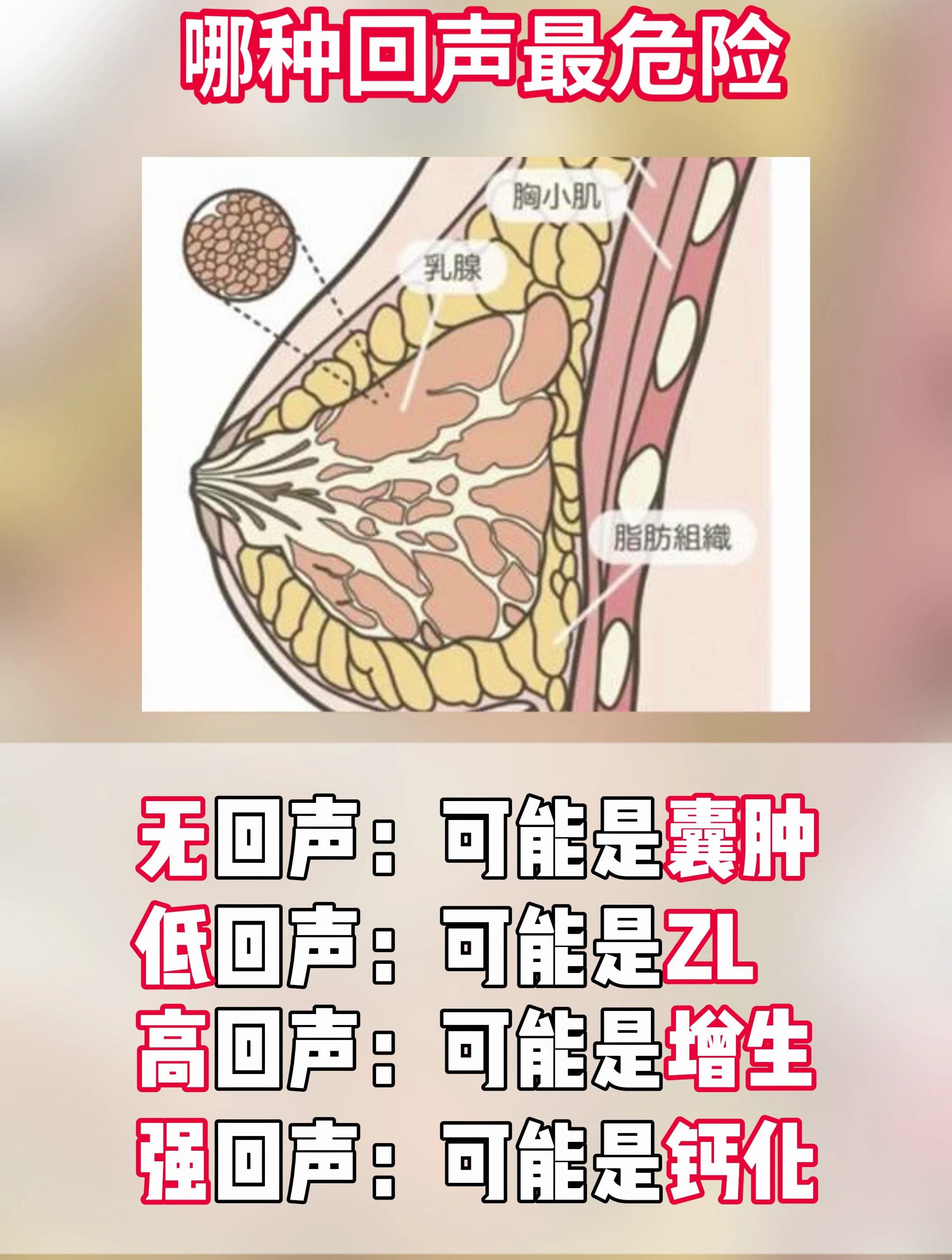 乳腺超声结构图图片