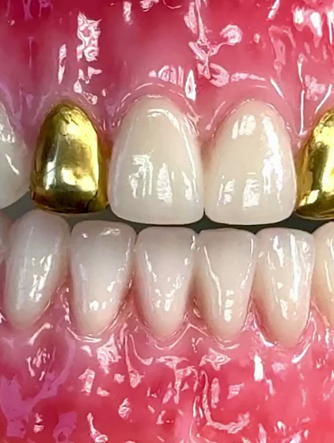 老板定做的大金牙!