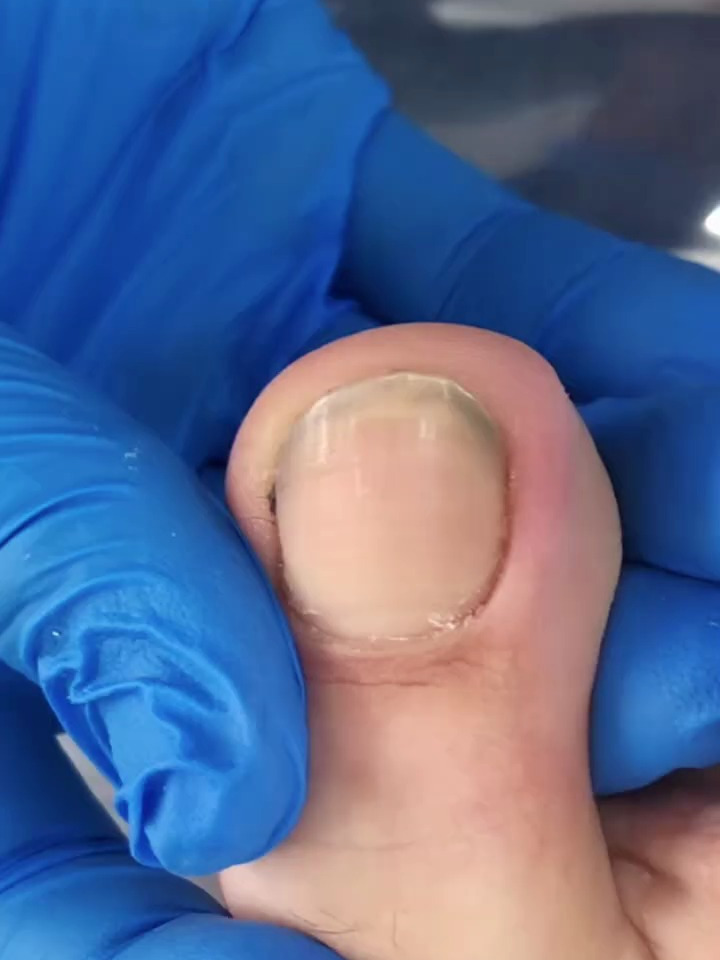 这指甲里都是啥玩意