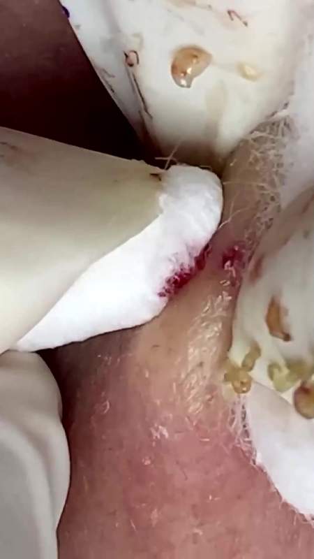 72万最后属实用力过猛了14.92万癞蛤蟆跳悬崖你跟我装什