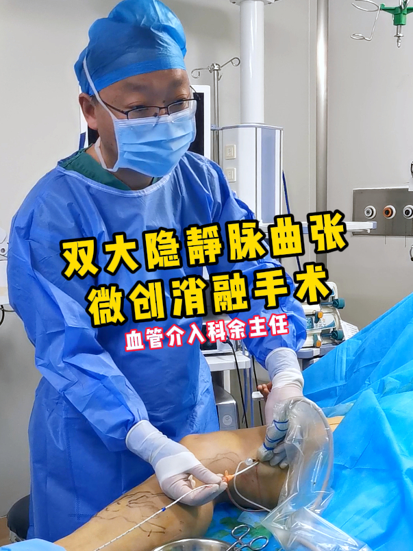 又一台双大隐静脉曲张,微创消融手术处理