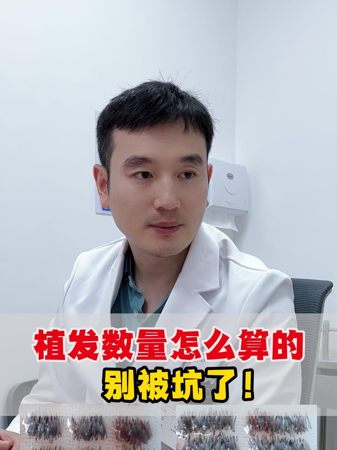 植发极限数量(植发最少植多少根)