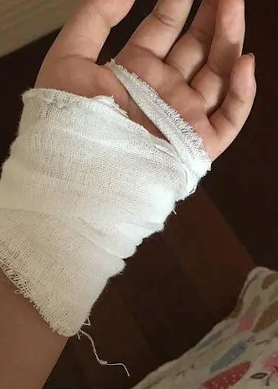 宝妈上班3天赚200,伤到手去医院治疗花了1000,网友:还是老老实实在家