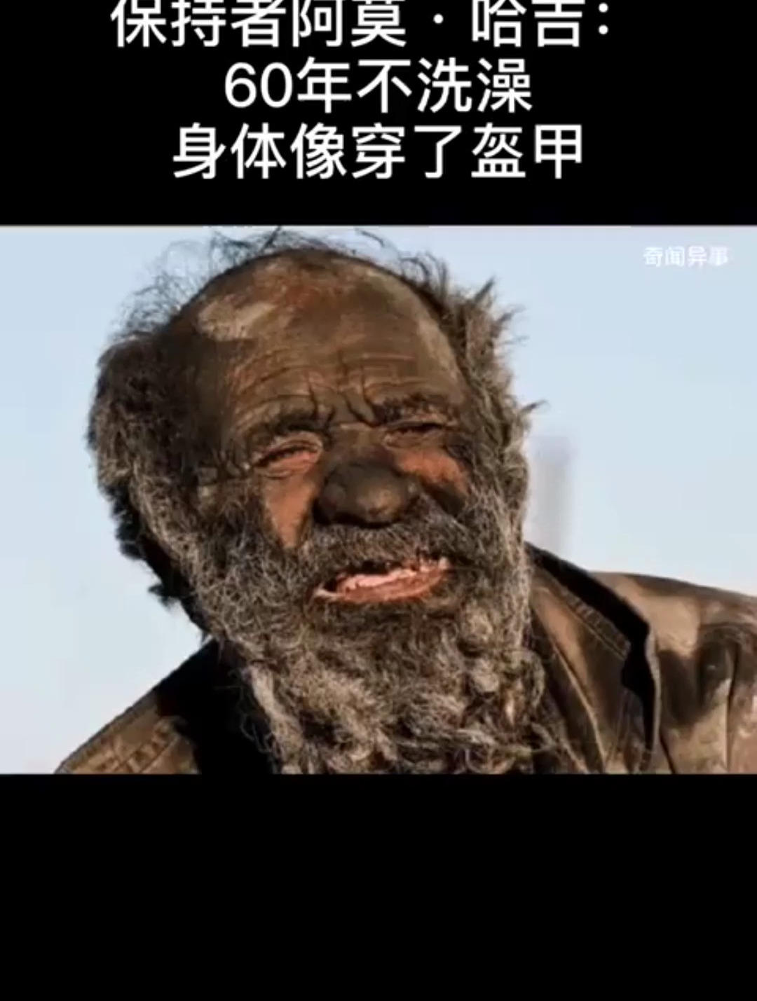特殊吉尼斯纪录保持者阿莫哈吉:60年不洗澡,身体像穿了盔甲