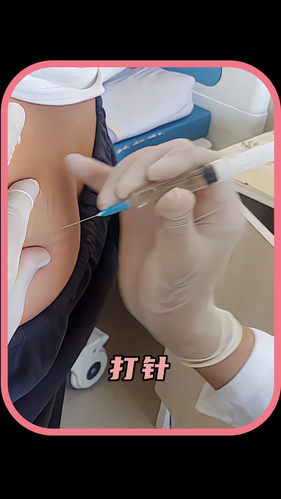 打针为啥都是打屁股和胳膊?-度小视