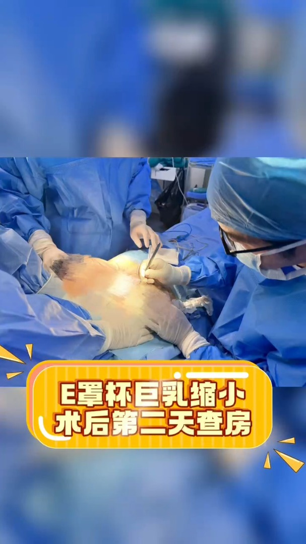 f罩杯巨乳缩小术后第二天查房