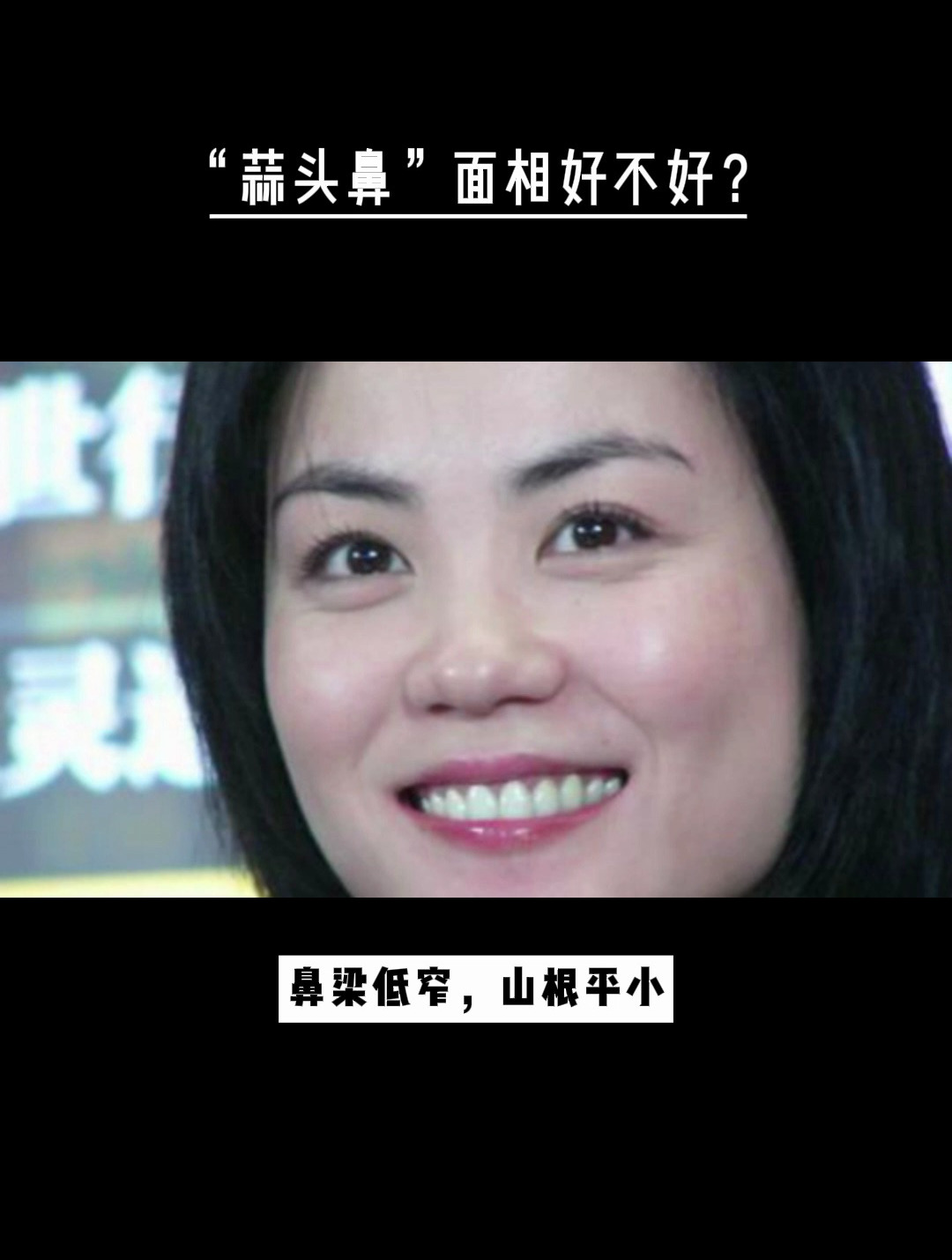 蒜头鼻面相好不好算命师傅虽然鼻形不美观但是命好