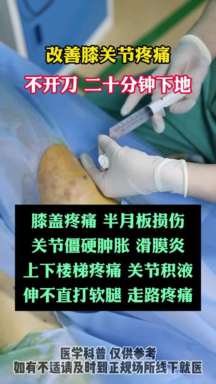 膝盖关节痛挂号什么科(膝盖关节疼挂什么科室的号)