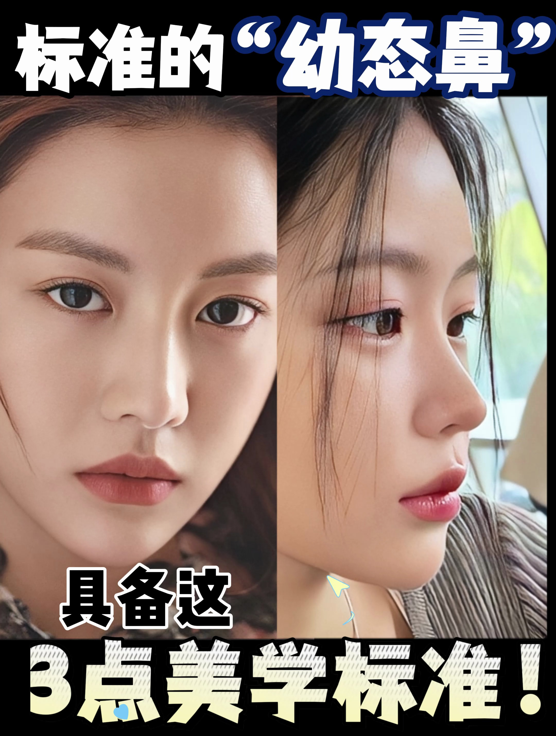 标准的幼态鼻具备这3点美学标准