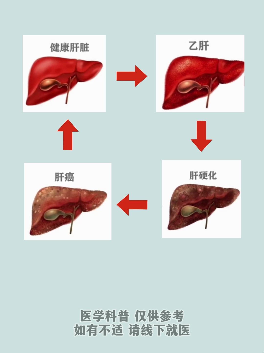 乙肝发展到肝癌需要多久