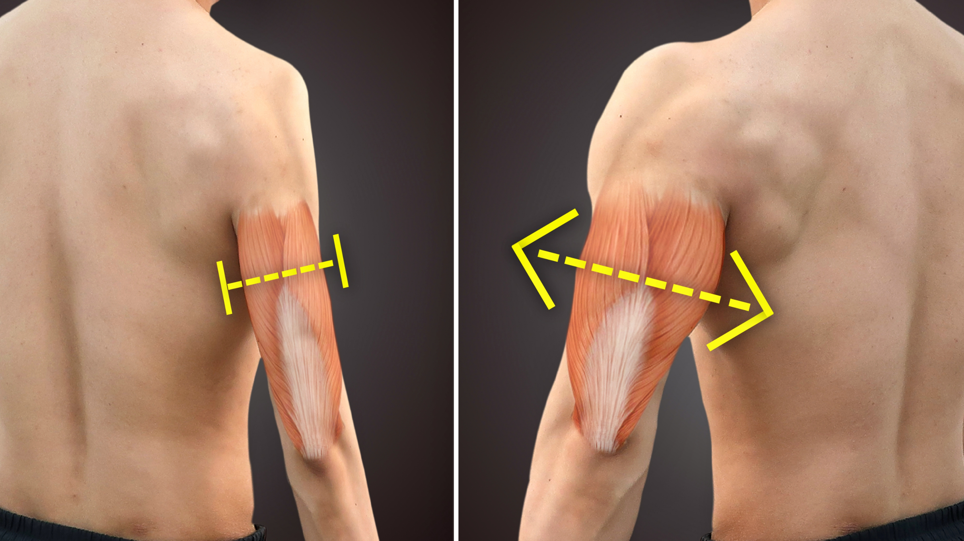 手臂太细可不行,3个技巧快速练粗!