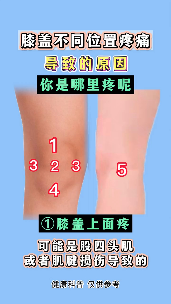膝盖不同位置疼痛 导致的原因 你是哪里疼呢?