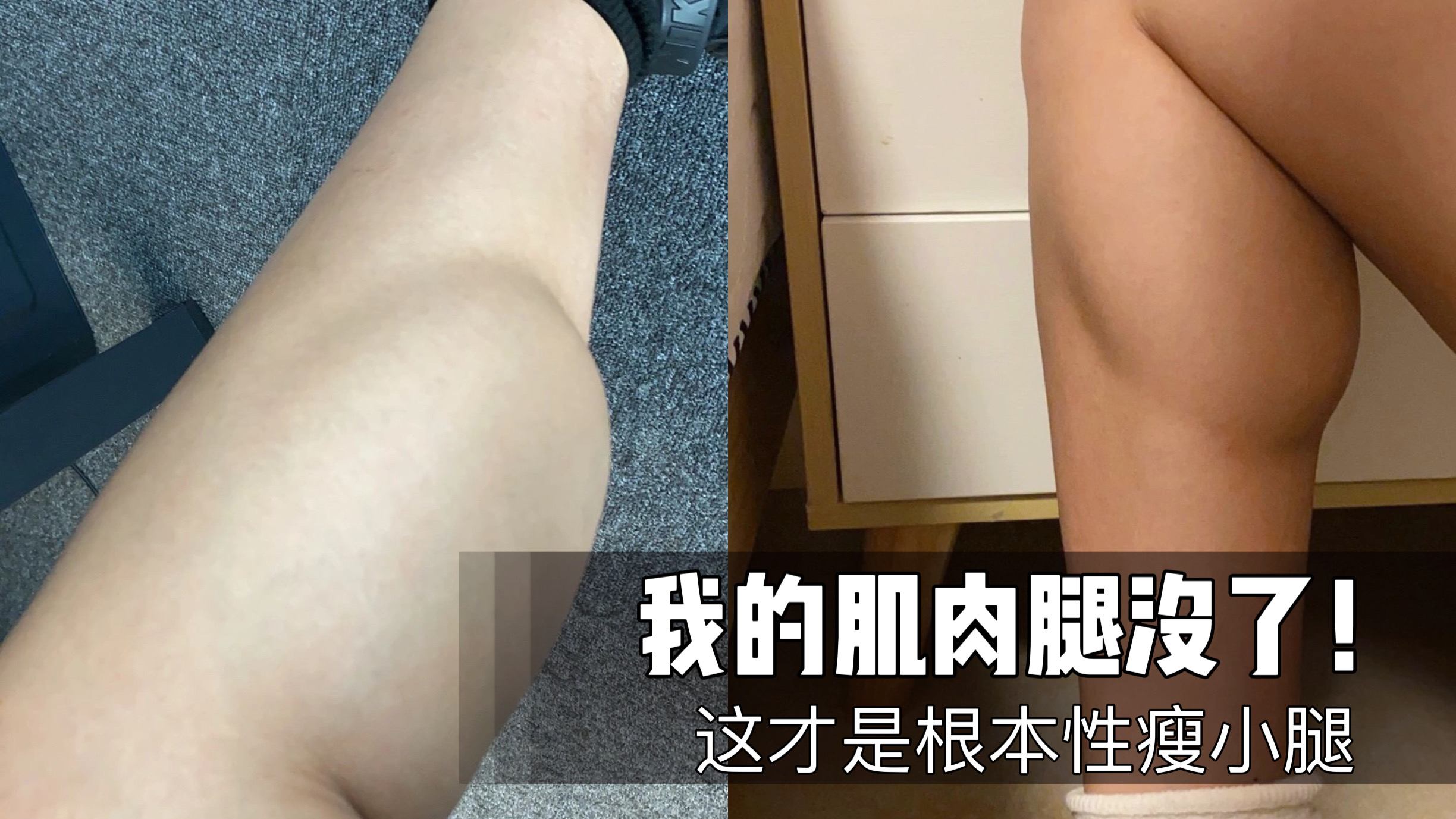 脂包肌必练!简直就是小腿肌肉发达自救教科书