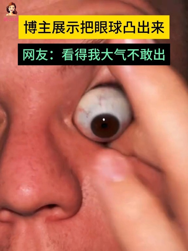 男子展示独家绝活可以把眼球凸出来网友看得我大气不敢出