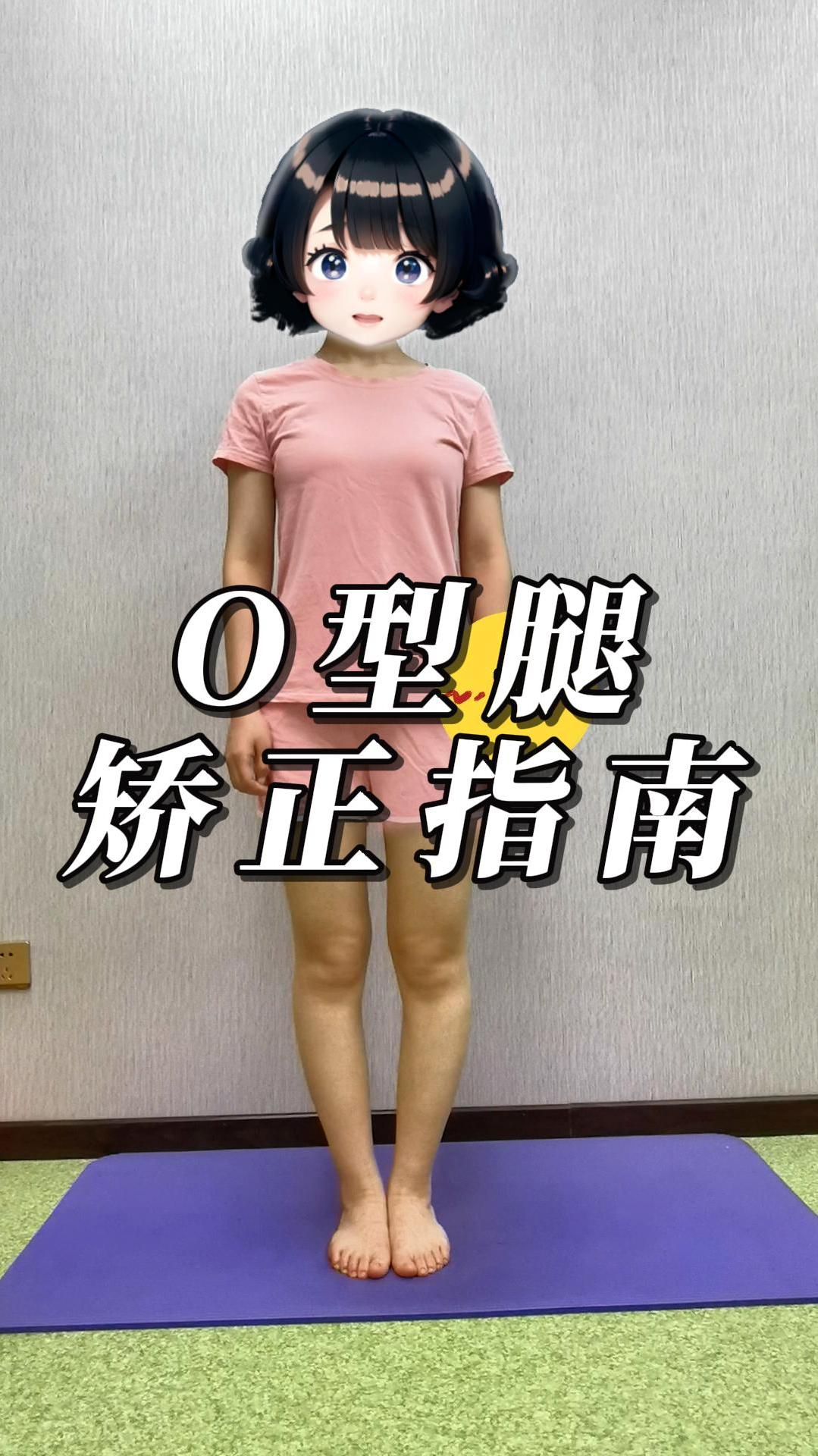 o型腿,膝盖下肢内旋如何矫正?