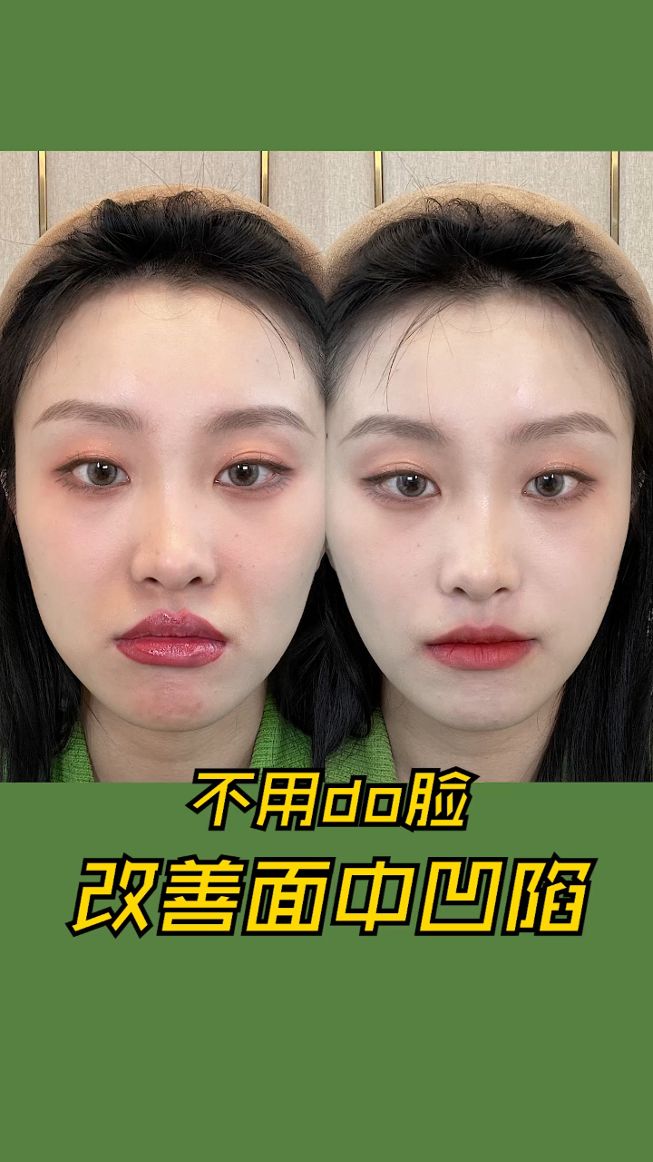 嘴凸面中凹陷通过化妆改善
