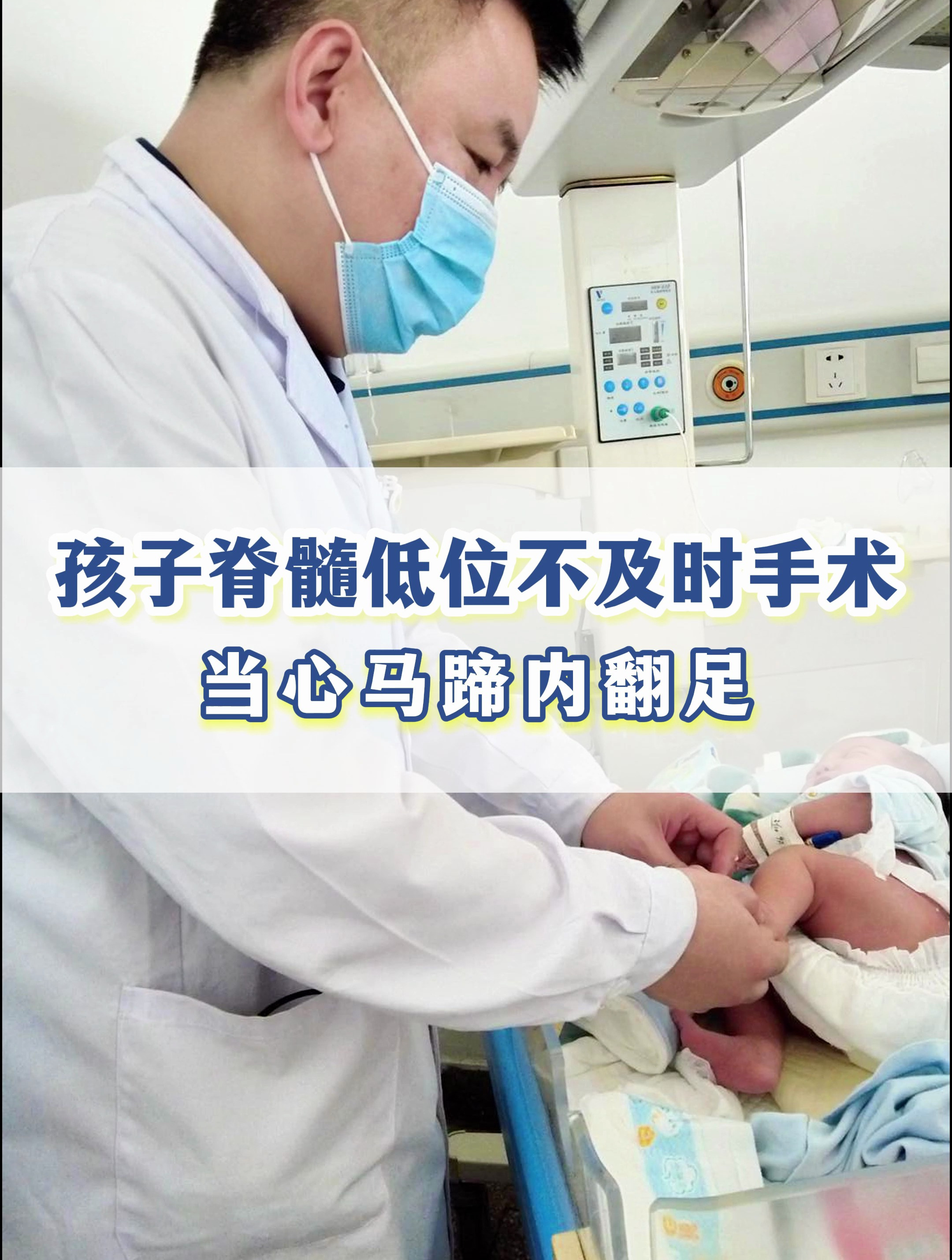 神经外科单峤孩子脊髓低位需及时手术否则可能形成马蹄内翻足