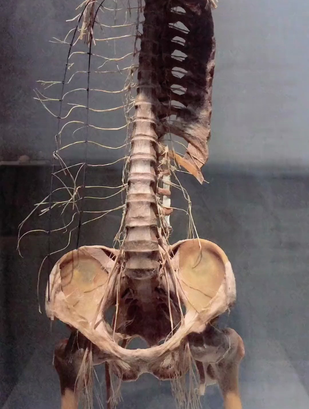 脊神经什么样子