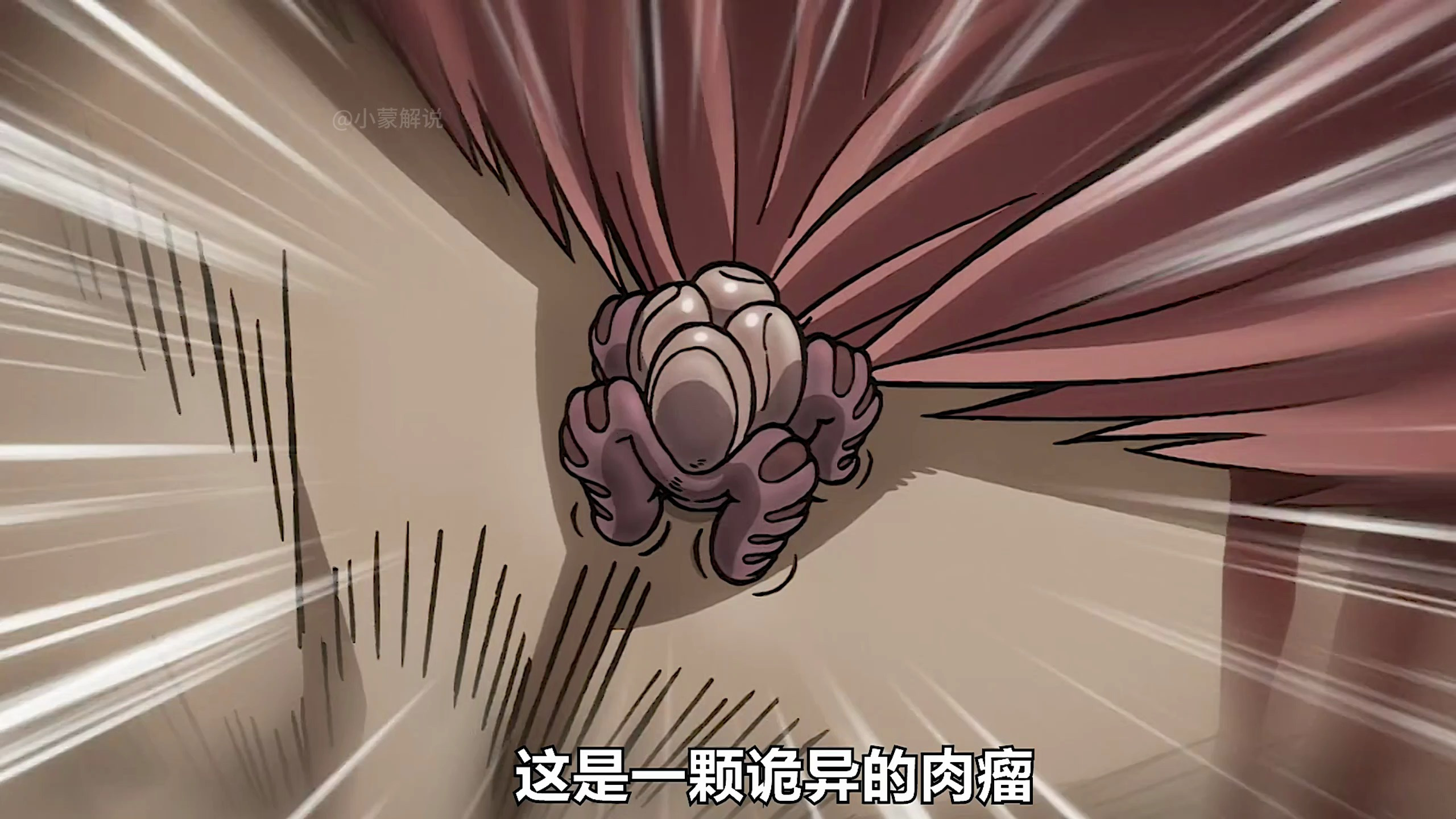 你知道如何取出扎根大脑的肉瘤吗?