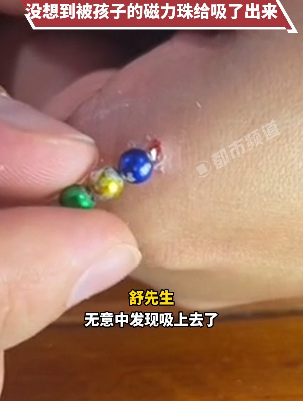 一岁孩子吃了一颗磁力球怎么办=一岁宝宝吃了磁铁会有什么症状?