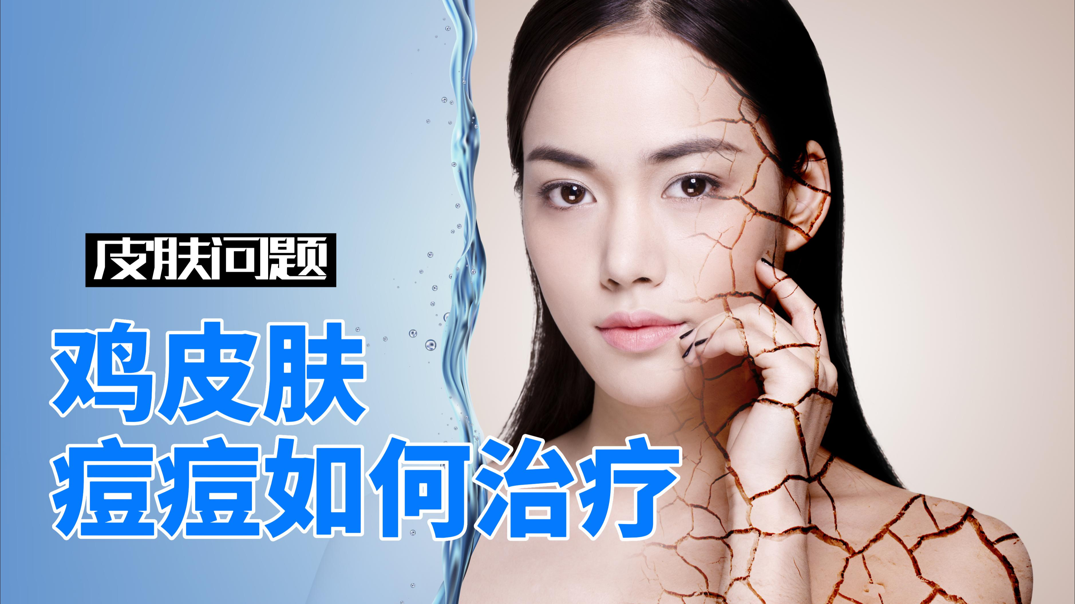 鸡皮肤、痘痘如何治疗