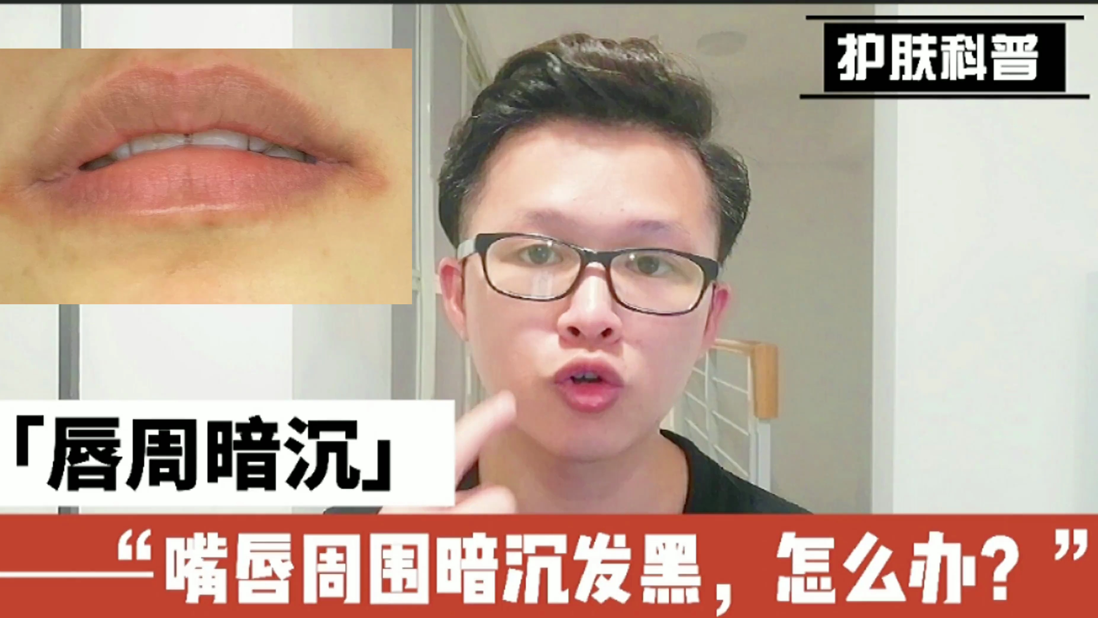 嘴唇周围容易暗沉发黑怎么办?都是这3个原因