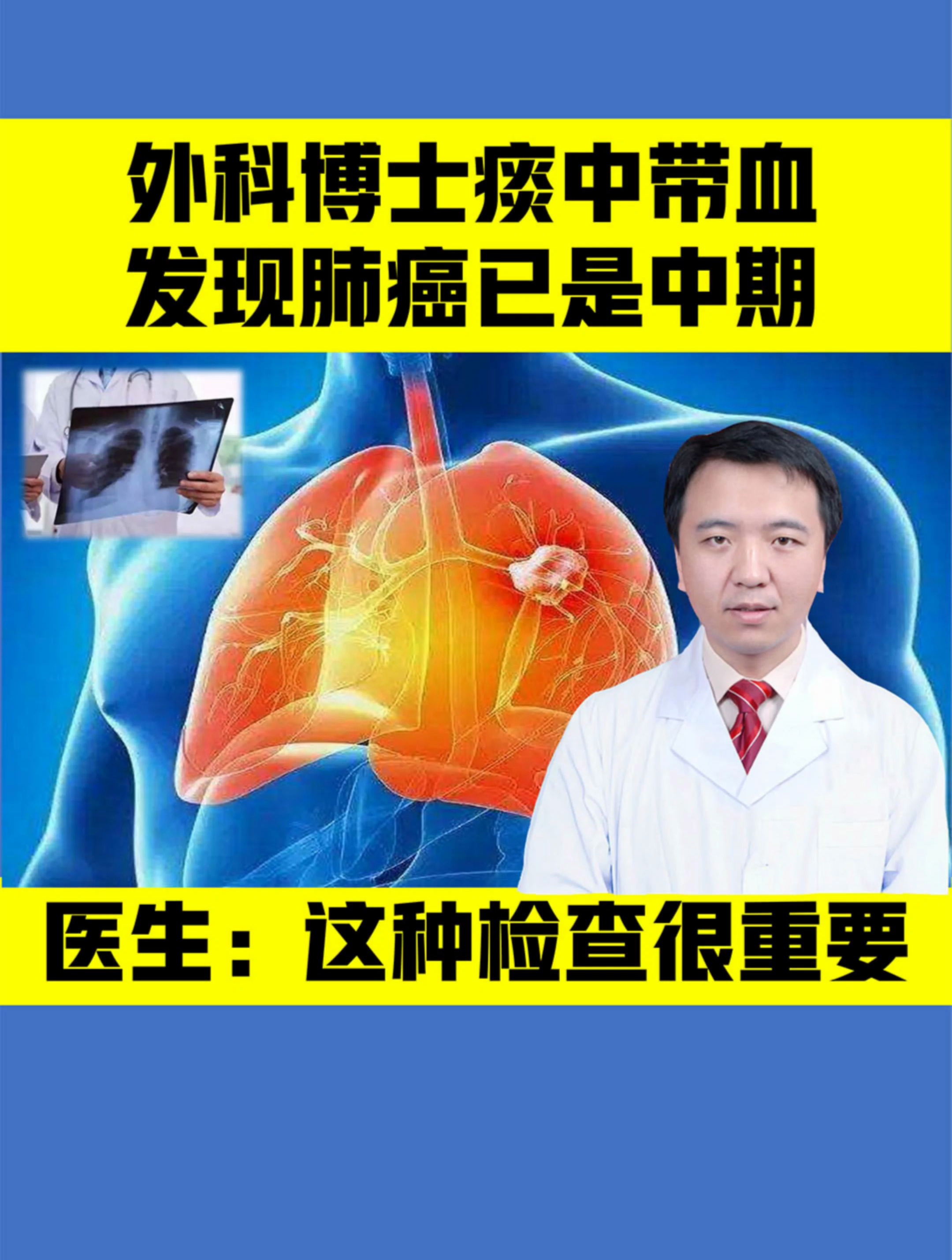 肺癌中期图片