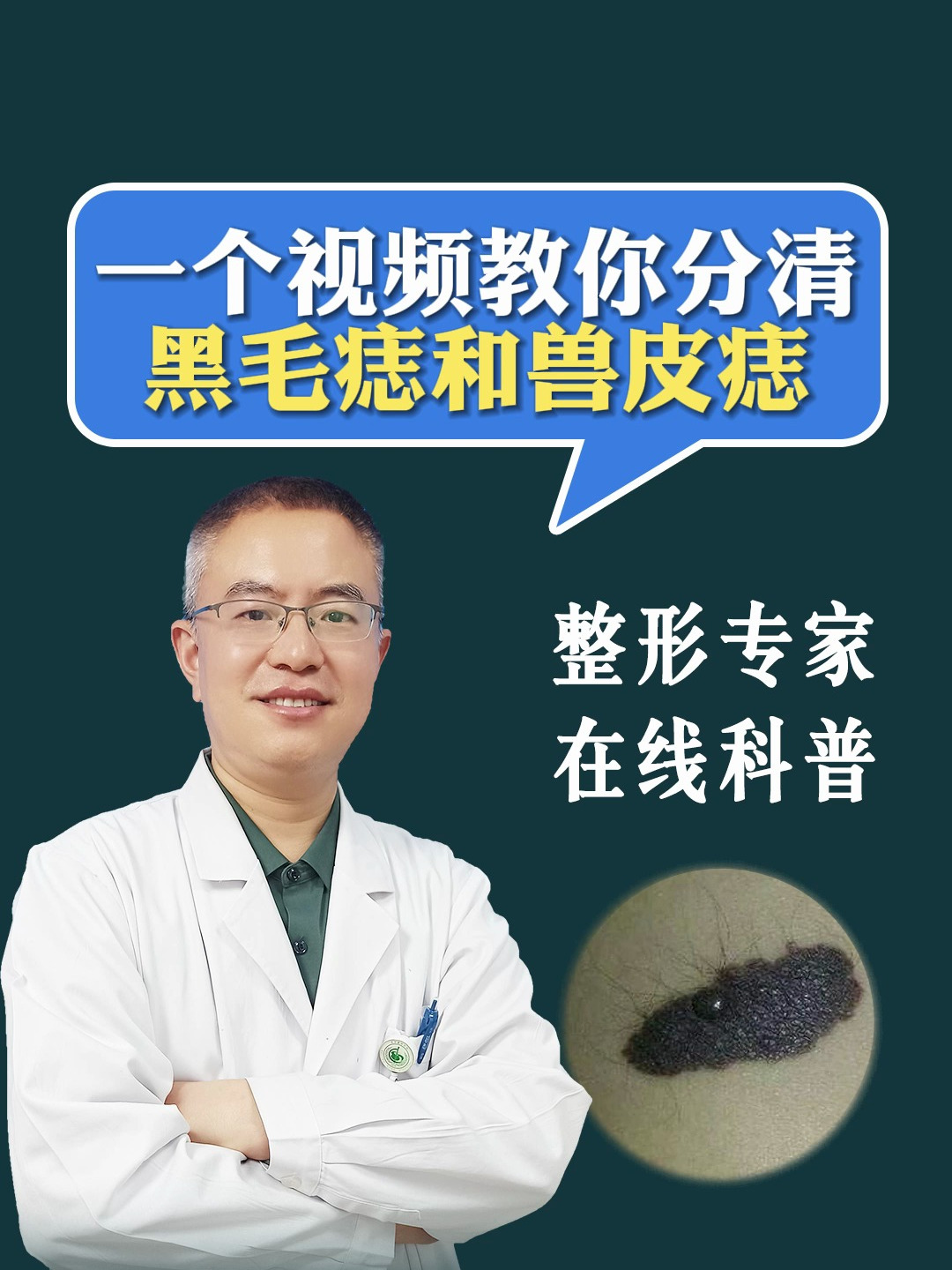 一个视频教你分清黑毛痣和兽皮痣