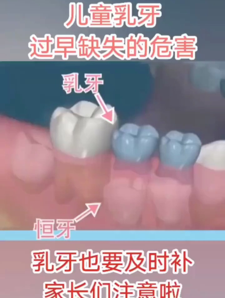 牙齿不齐,乳牙早失的危害