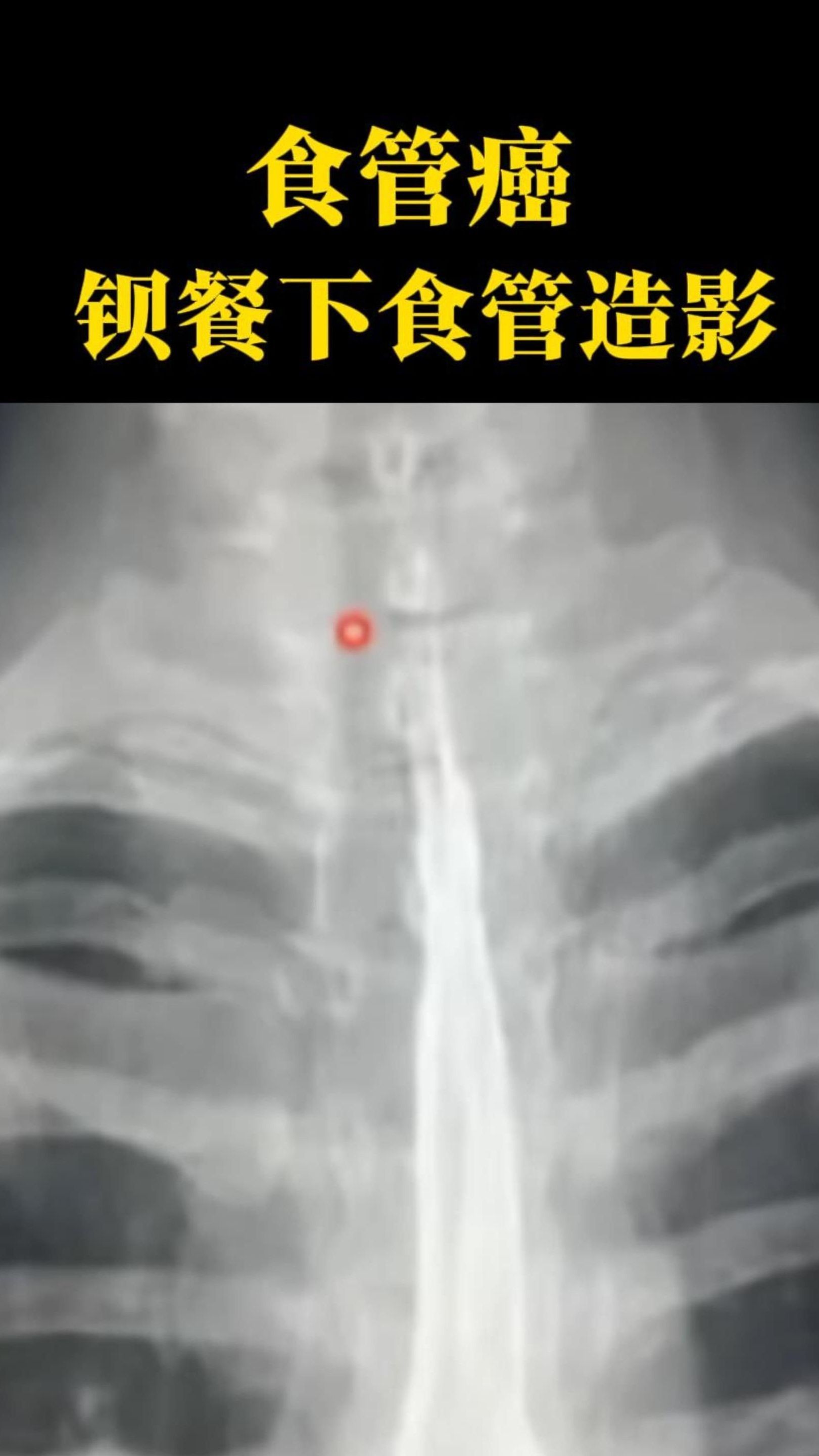 为什么医院不推荐钡餐检查做了钡餐能再做胃镜吗为什么在线 为什么医院不推荐钡餐检查做了钡餐能再做胃镜吗为什么在线