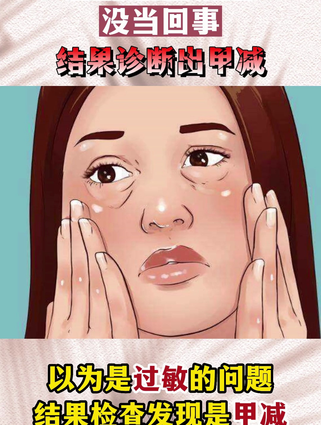 水肿脸小心是甲减