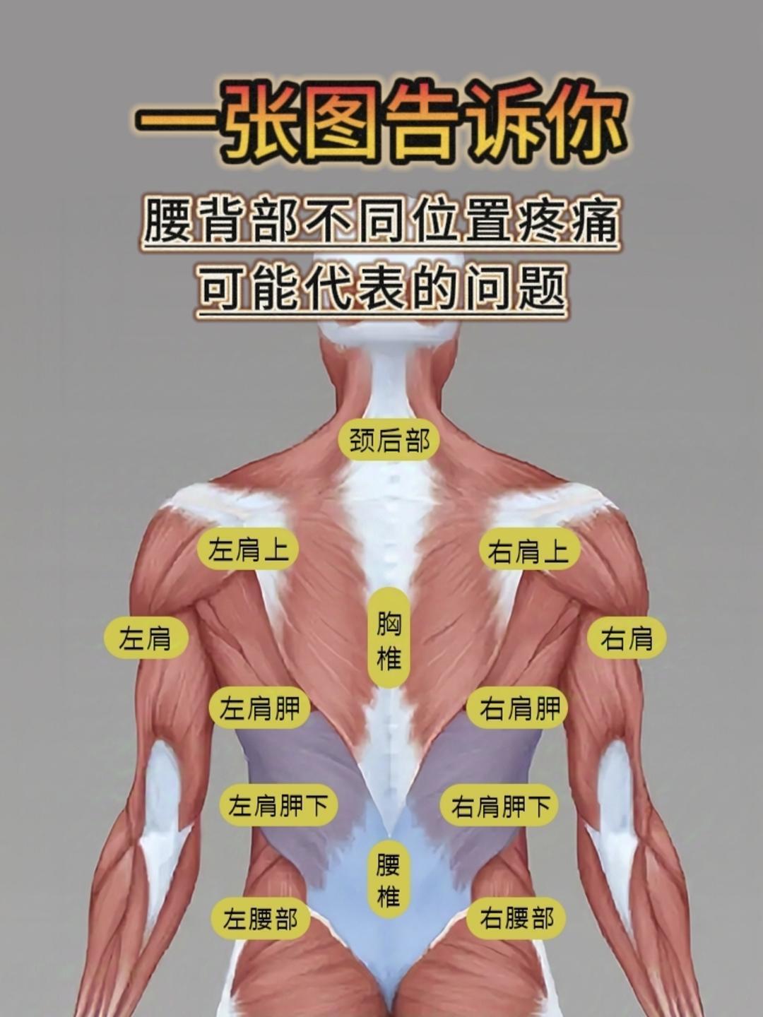 一张图告诉你,腰背部不同位置疼痛可能代表的问题