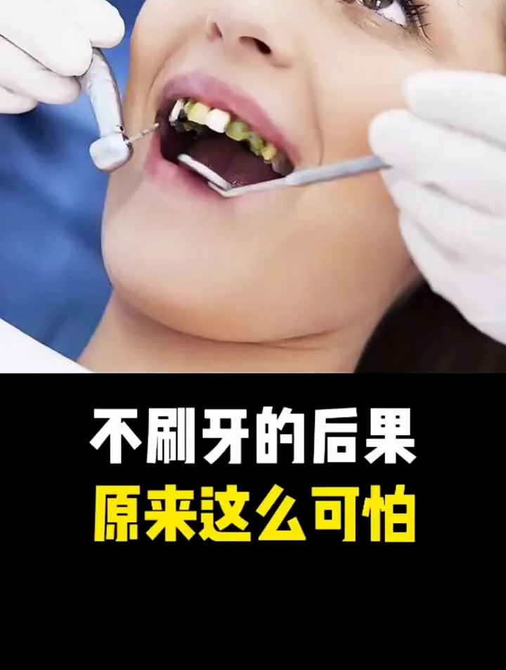 不刷牙的后果,原来这么可怕!科普-度小视