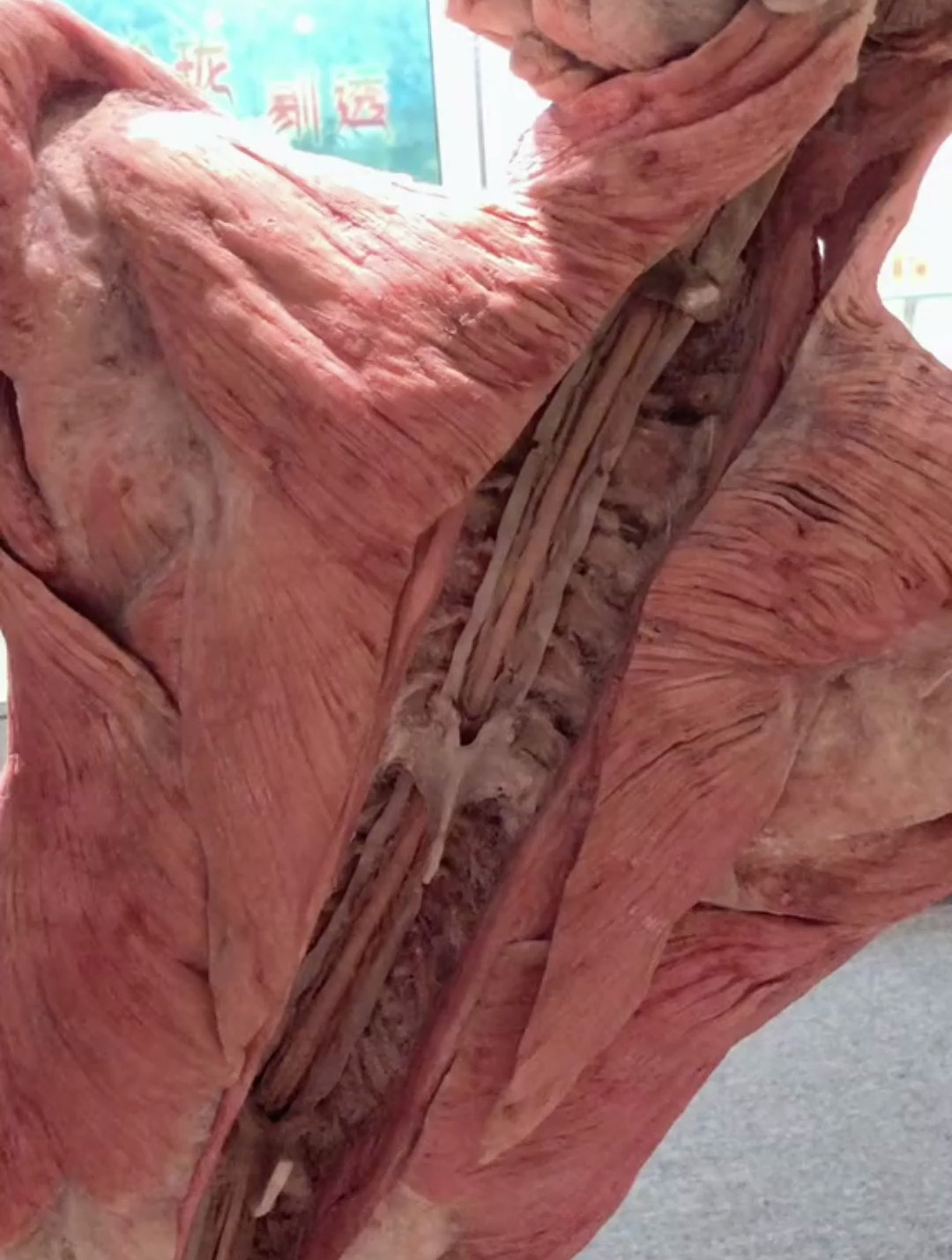 脊髓是什么?标本 科普 博物馆