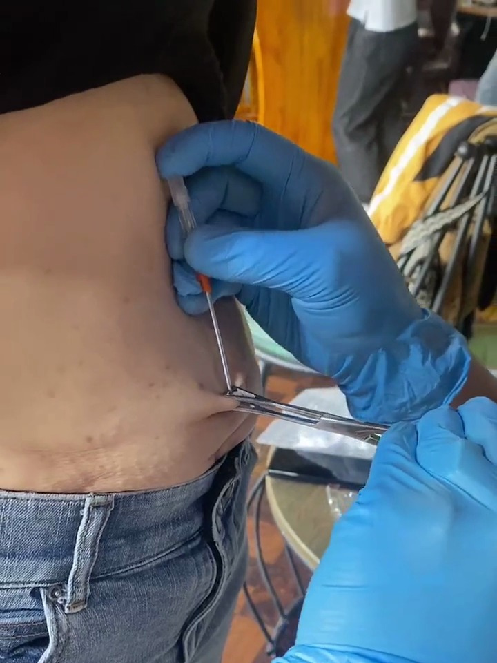 离异妈妈谈了个小男友激动地跑来打脐钉看着都疼啊