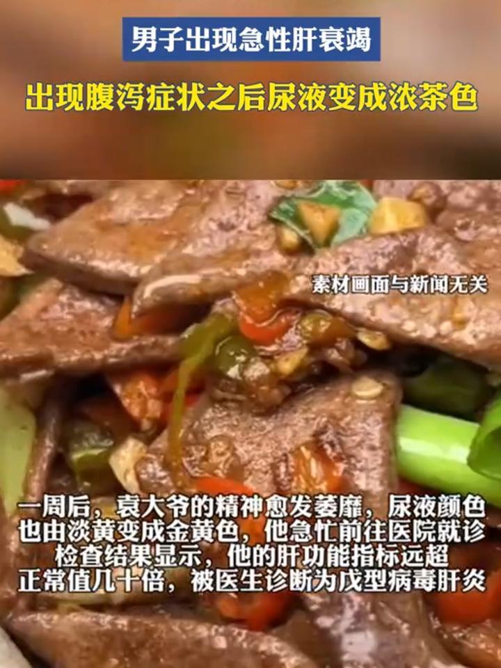 尿色如浓茶是什么病图片