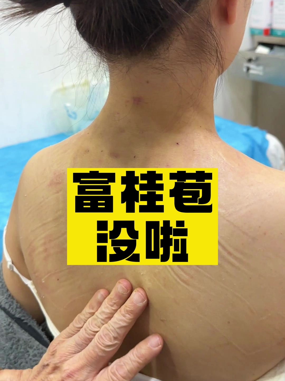20分钟可以打造少女背嘛