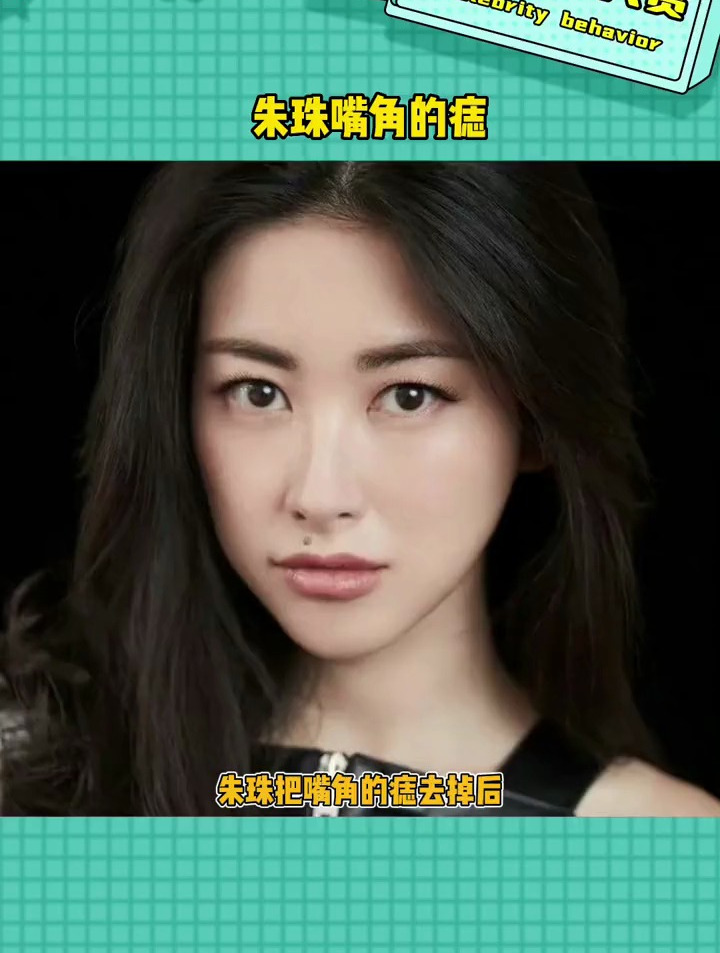 长好了是标志,长不好影响颜值呀 朱珠嘴角的痣