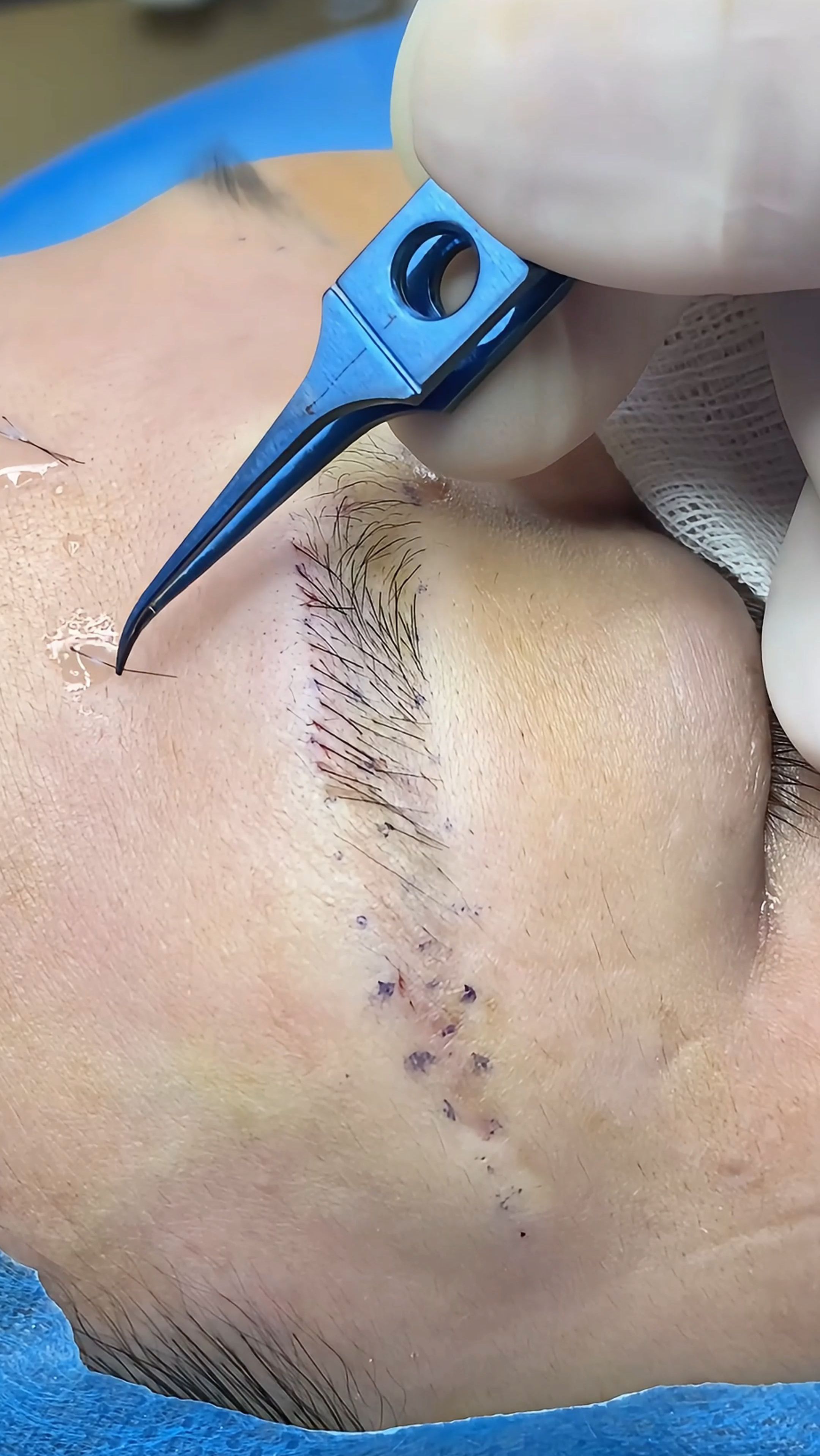 从此和纹眉说再见,植眉进行时