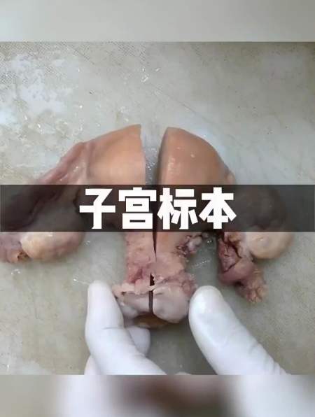 真实人体标本子宫,能从橙子般大小膨胀至500倍,致敬伟大的母亲-度小视