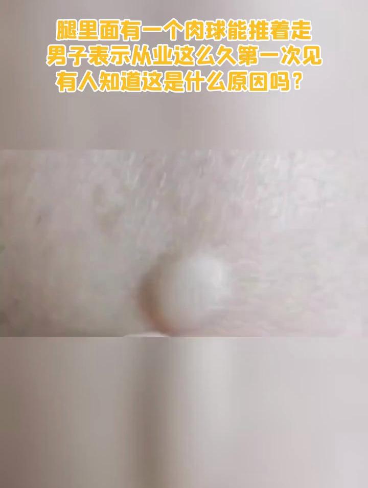 腿里面有一个肉球能推着走 男子表示从业这么久第一次见 有人知道这是什么原因吗?