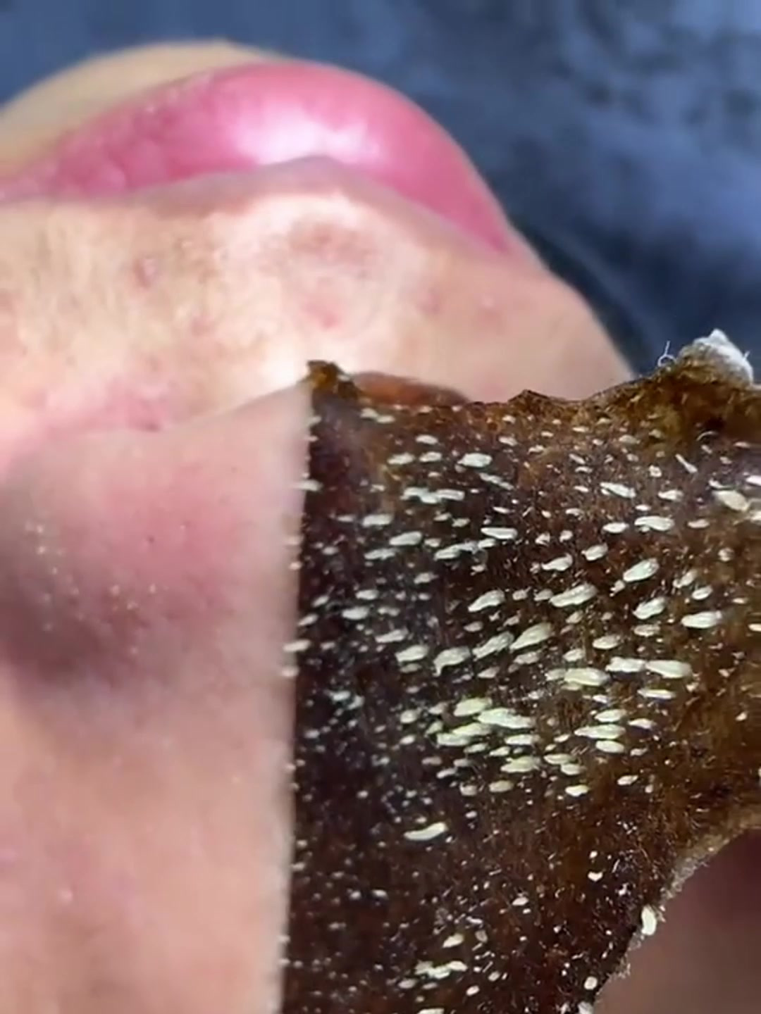 吸黑头鼻膜贴粘出了好多大黑头,强迫症看了很享受