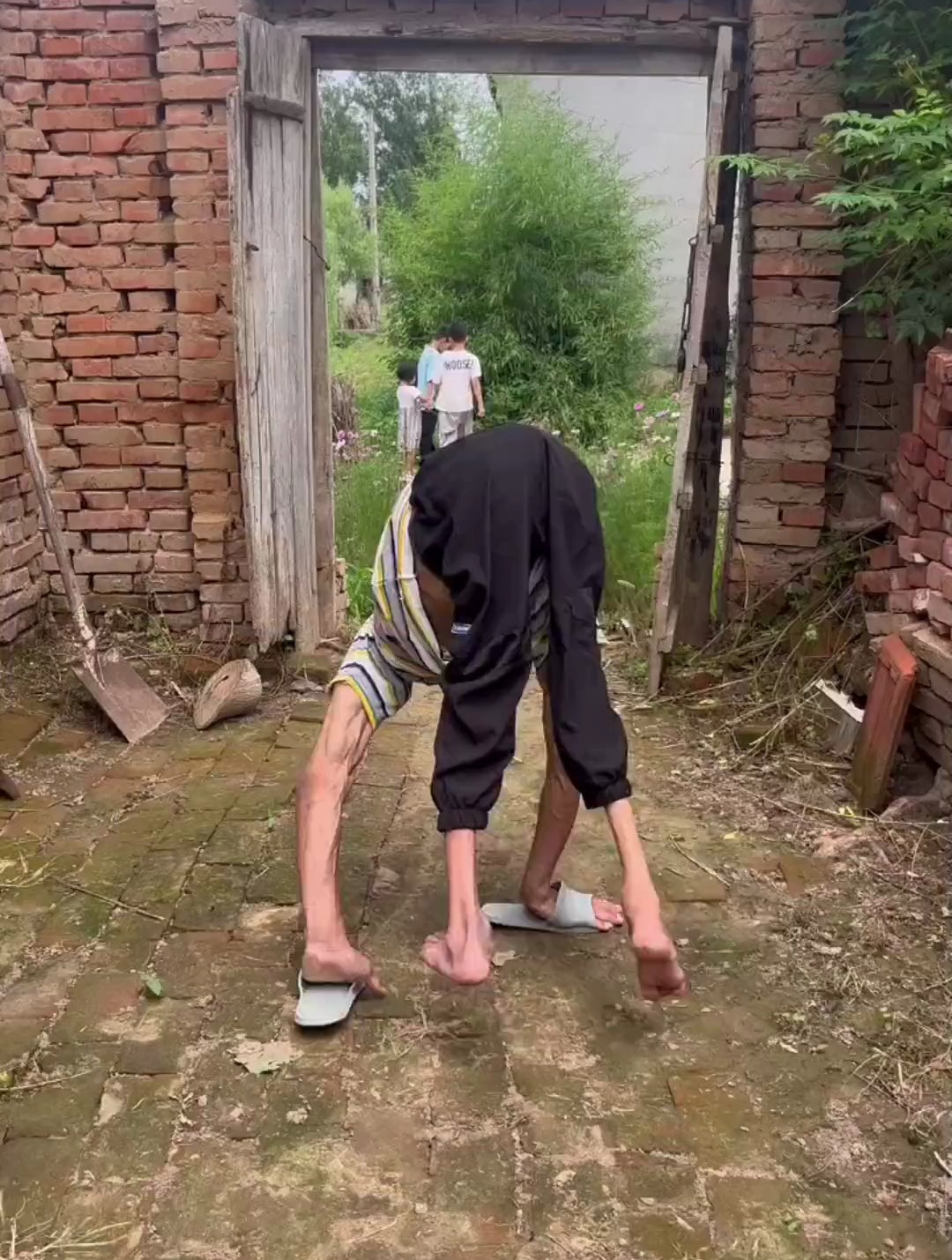 一岁时发高烧导致小儿麻痹症,从此双脚无法行走,但他一直在努力