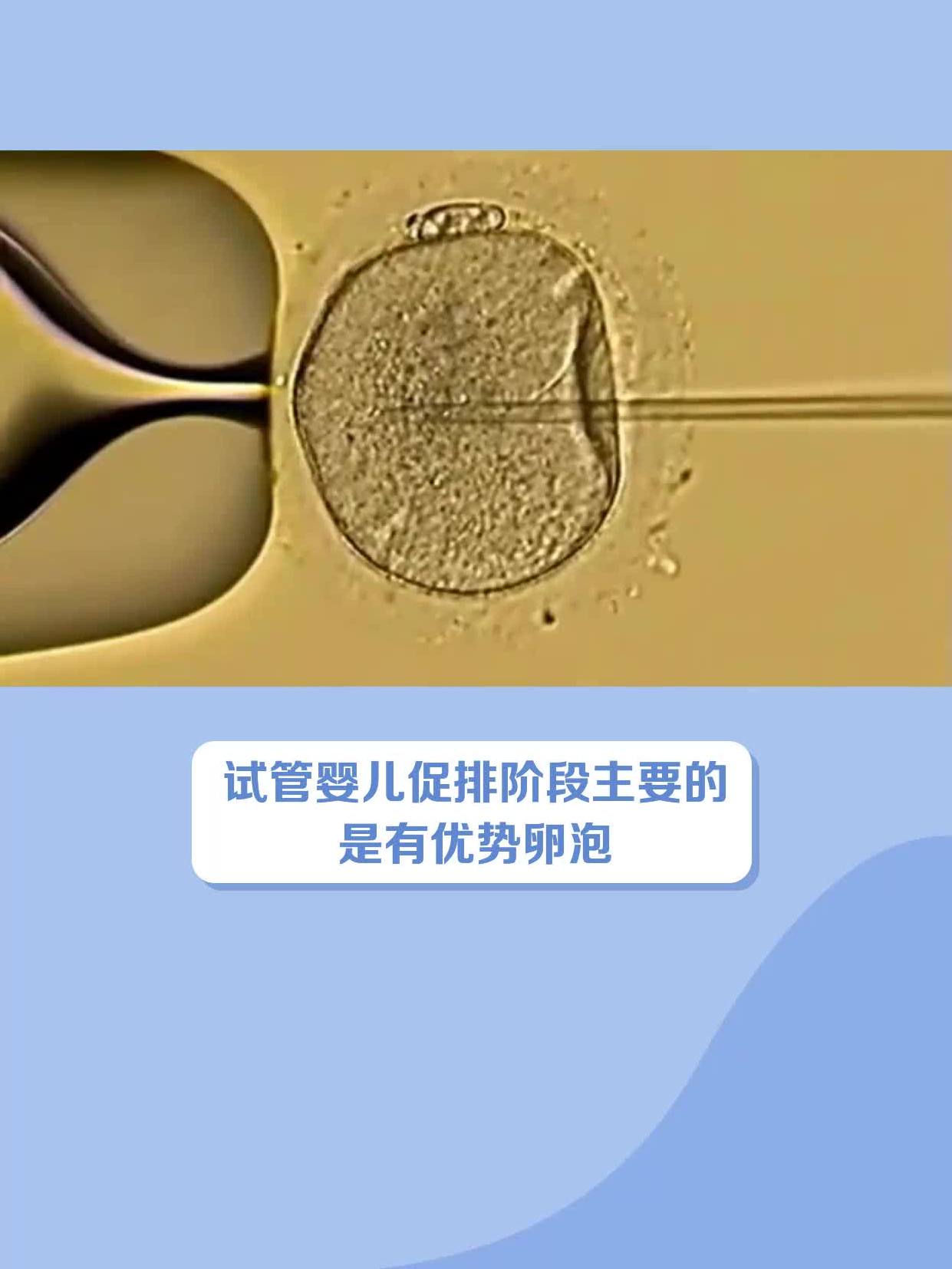 试管取卵空卵泡_试管取卵空卵泡还会取出来吗
