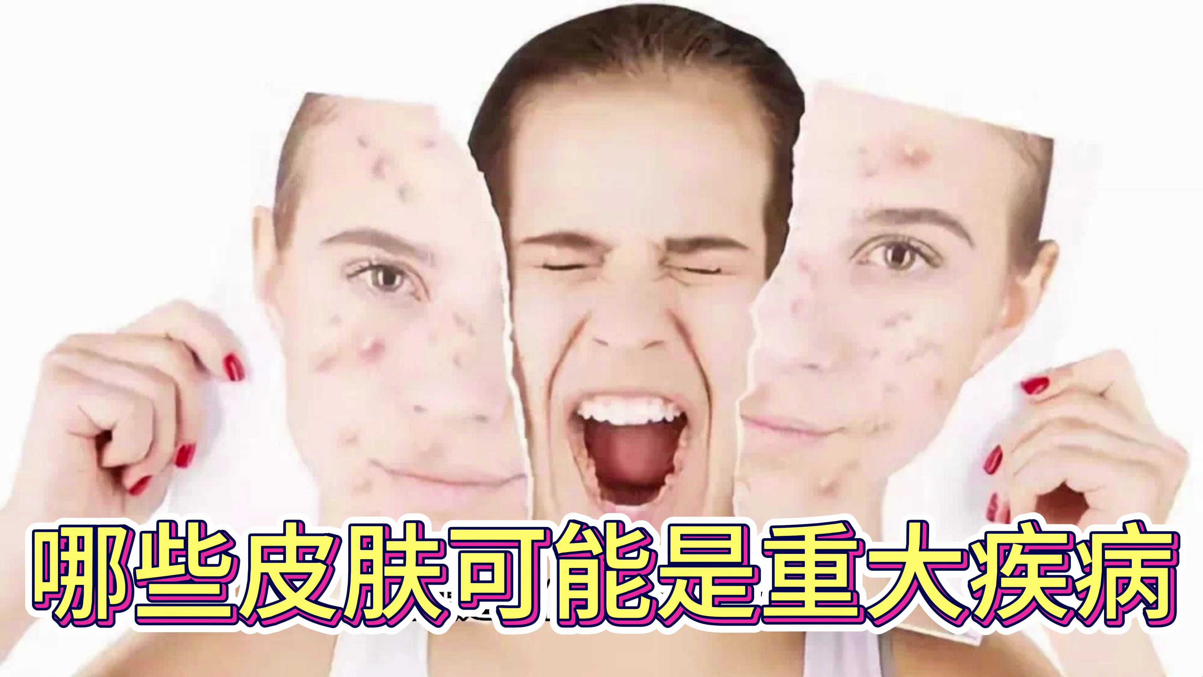 哪些皮肤变化,可能是重大疾病?