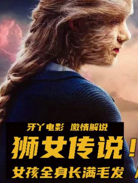 女孩全身长满毛发,被同学嘲笑,欺辱,最终竟成为大学教授!-度小视