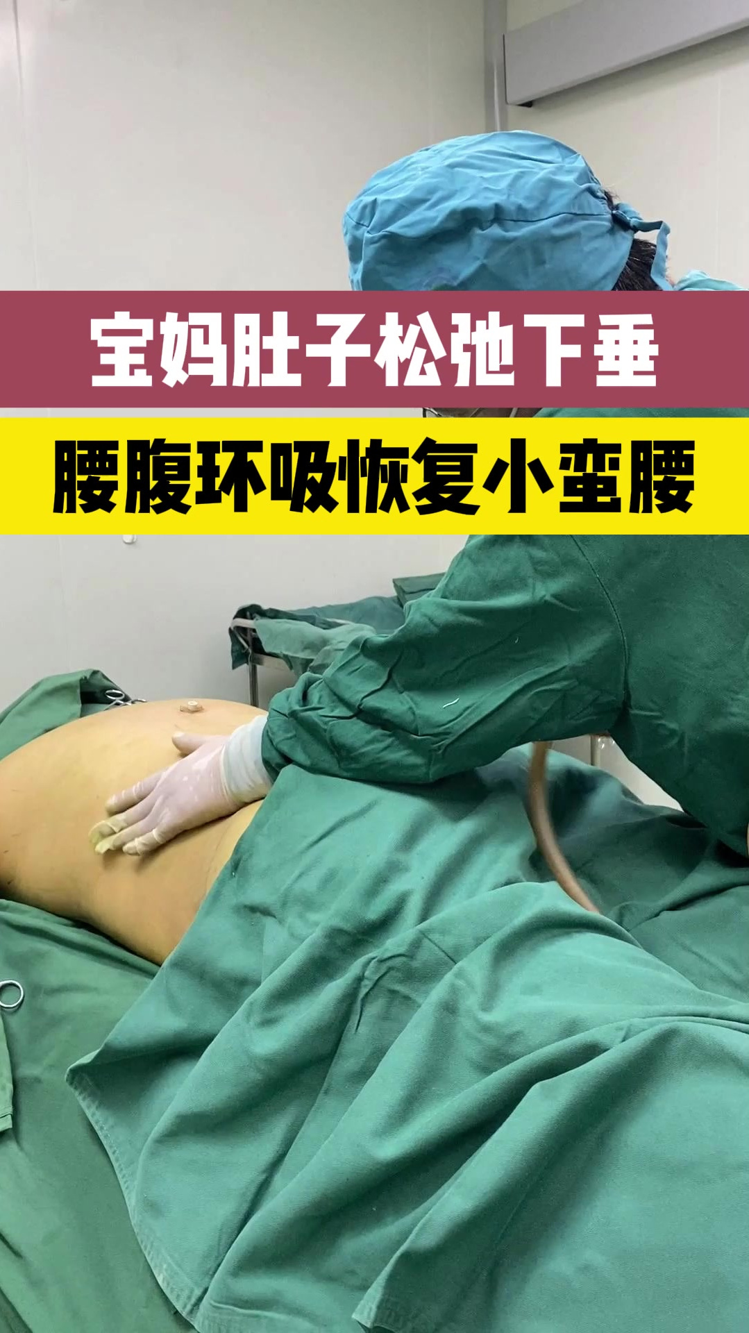 腰腹环吸多久恢复图片